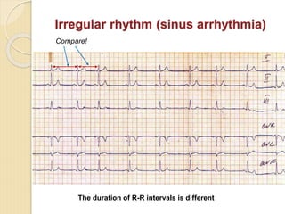 Comprehensive Introduction to Clinical Electrocardiography and ECG ...