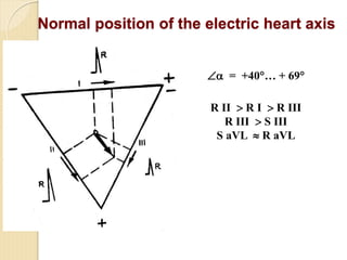 Comprehensive Introduction to Clinical Electrocardiography and ECG ...