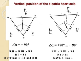 Comprehensive Introduction to Clinical Electrocardiography and ECG ...
