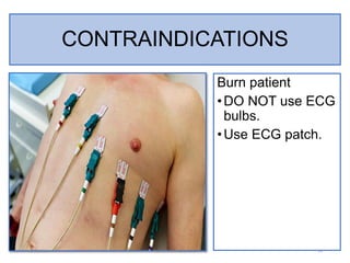 ECG 1 Procedure ECG pptx ecg-1-procedure-ecg-pptx