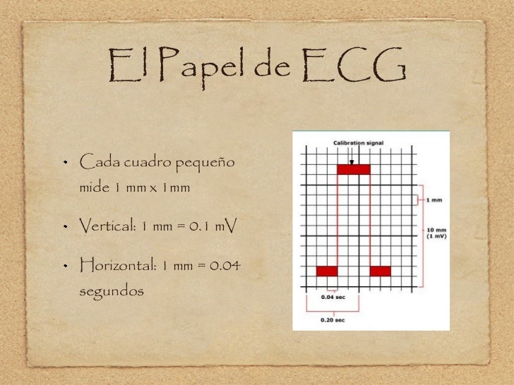Electrocardiografía Básica