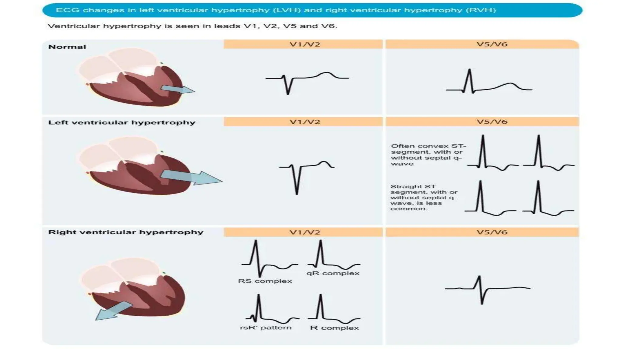 ECG basics simplified for students .pptx