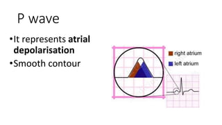 P wave
•It represents atrial
depolarisation
•Smooth contour
 