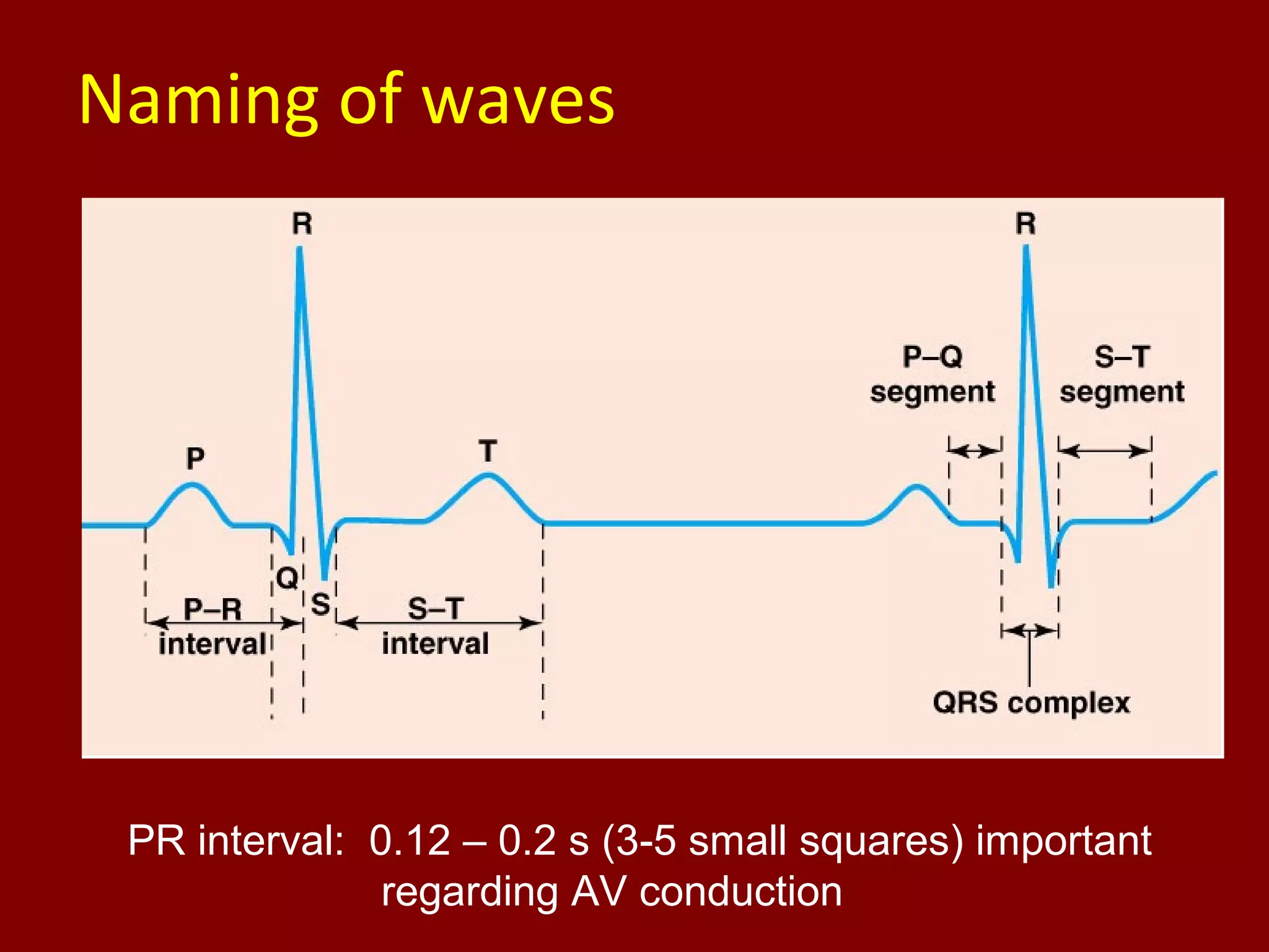 Naming of waves
PR interval: 0.12 – 0.2 s (3-5 small squares) important
regarding AV conduction
 