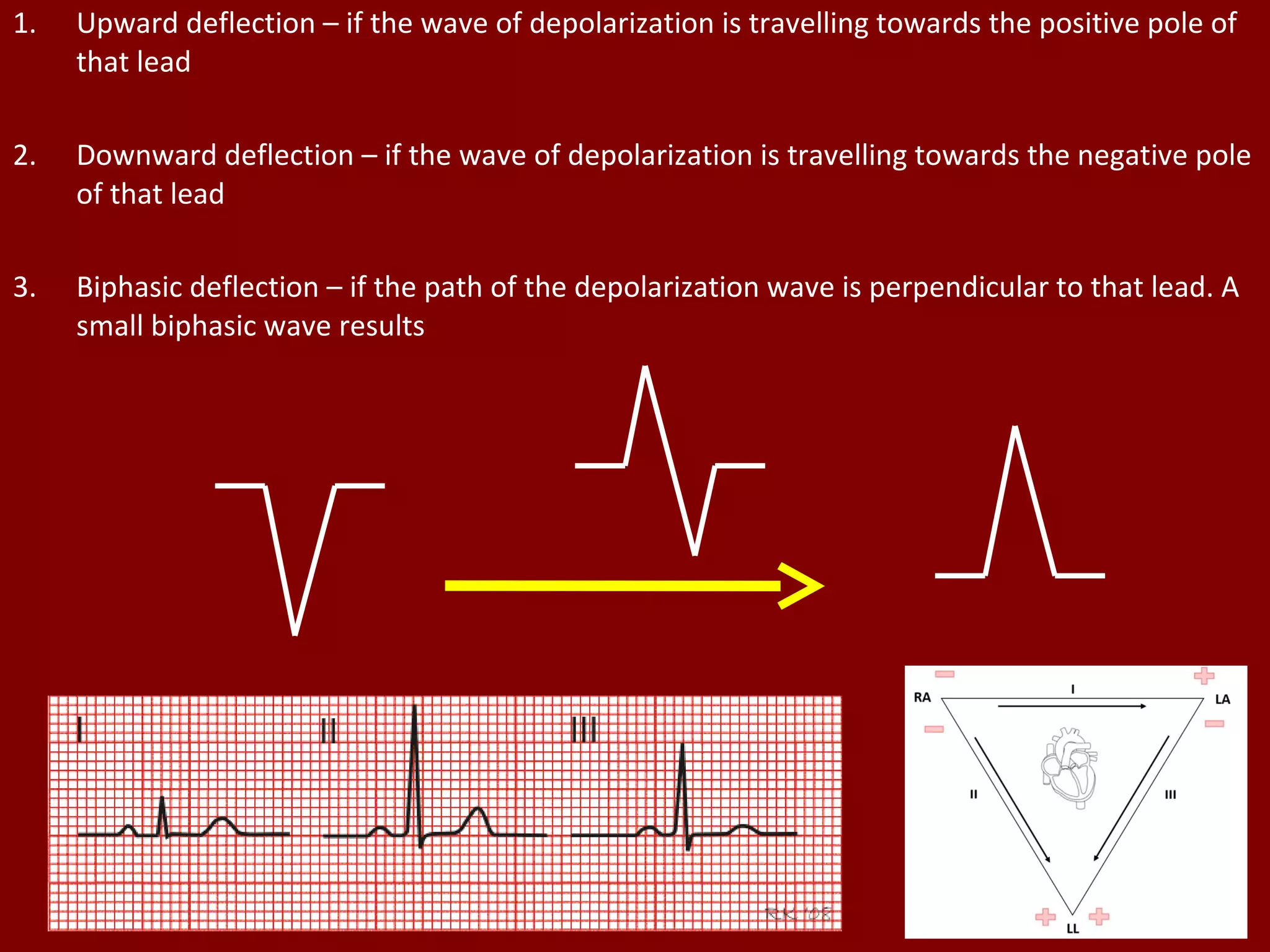 1. Upward deflection – if the wave of depolarization is travelling towards the positive pole of
that lead
2. Downward deflection – if the wave of depolarization is travelling towards the negative pole
of that lead
3. Biphasic deflection – if the path of the depolarization wave is perpendicular to that lead. A
small biphasic wave results
 