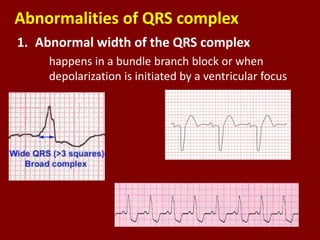 Ecg 2019 b | PPTX
