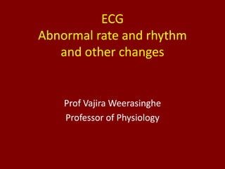 ECG
Abnormal rate and rhythm
and other changes
Prof Vajira Weerasinghe
Professor of Physiology
 