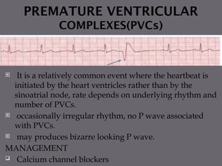 Electro Cardio Gram for Nursing team to identify | PPTX