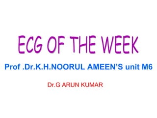 Prof .Dr.K.H.NOORUL AMEEN’S unit M6 Dr.G ARUN KUMAR ECG OF THE WEEK 