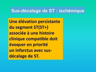 Une élévation persistante
du segment ST(ST+)
associée à une histoire
clinique compatible doit
évoquer en priorité
un infarctus avec susdécalage de ST.

 