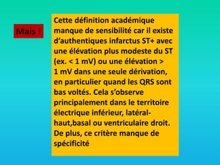 Mais !

Cette définition académique
manque de sensibilité car il existe
d’authentiques infarctus ST+ avec
une élévation plus modeste du ST
(ex. < 1 mV) ou une élévation >
1 mV dans une seule dérivation,
en particulier quand les QRS sont
bas voltés. Cela s’observe
principalement dans le territoire
électrique inférieur, latéralhaut,basal ou ventriculaire droit.
De plus, ce critère manque de
spécificité

 