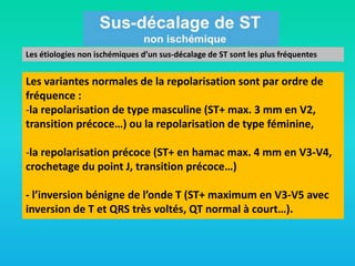 Les étiologies non ischémiques d’un sus-décalage de ST sont les plus fréquentes

Les variantes normales de la repolarisation sont par ordre de
fréquence :
-la repolarisation de type masculine (ST+ max. 3 mm en V2,
transition précoce…) ou la repolarisation de type féminine,
-la repolarisation précoce (ST+ en hamac max. 4 mm en V3-V4,
crochetage du point J, transition précoce…)

- l’inversion bénigne de l’onde T (ST+ maximum en V3-V5 avec
inversion de T et QRS très voltés, QT normal à court…).

 