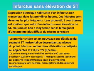 Expression électrique habituelle d’un infarctus non
transmural dans les premières heures. Ces infarctus sont
devenus les plus fréquents. Leur pronostic à court terme
est meilleur que celui d’un infarctus avec élévation de
ST, mais moins bon à long terme car ils témoignent
d’une atteinte plus diffuse du réseau coronaire
Le premier critère est un nouveau sous-décalage du
segment ST horizontal ou descendant au niveau
du point J dans au moins deux dérivations contiguës
ou adjacentes et ≥ 0,05 mV (0,5 mm).
Ce critère manque de sensibilité en V2-V3 où tout sousdécalage < 0,05 mV est suspect. Il manque aussi de spécificité
car s’observe fréquemment au cours d’un syndrome
coronarien aigu sans nécrose, mais également dans diverses
pathologies

 