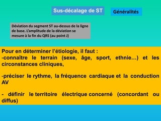 Généralités
Déviation du segment ST au-dessus de la ligne
de base. L’amplitude de la déviation se
mesure à la fin du QRS (au point J)

Pour en déterminer l’étiologie, il faut :
-connaître le terrain (sexe, âge, sport, ethnie…) et les
circonstances cliniques,
-préciser le rythme, la fréquence cardiaque et la conduction
AV

- définir le territoire électrique concerné (concordant ou
diffus)

 