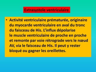 Extrasystole ventriculaire
• Activité ventriculaire prématurée, originaire
du myocarde ventriculaire en aval du tronc
du faisceau de His. L’influx dépolarise
le muscle ventriculaire de proche en proche
et remonte par voie rétrograde vers le nœud
AV, via le faisceau de His. Il peut y rester
bloqué ou gagner les oreillettes.

 