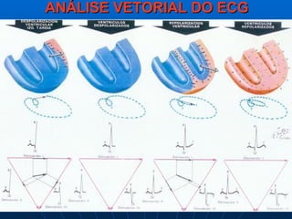 ANÁLISE VETORIAL DO ECG
 