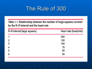 The Rule of 300
 