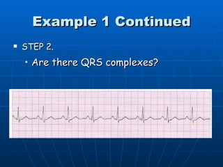 Example 1 Continued
   STEP 2.
    • Are there QRS complexes?
 