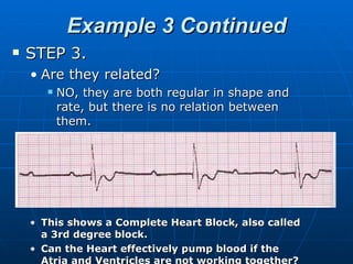 Example 3 Continued
   STEP 3.
    • Are they related?
          NO, they are both regular in shape and
           rate, but there is no relation between
           them.




    • This shows a Complete Heart Block, also called
      a 3rd degree block.
    • Can the Heart effectively pump blood if the
      Atria and Ventricles are not working together?
 