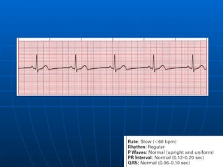 Ecg 3.0