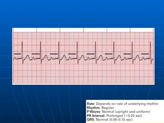 Ecg 3.0