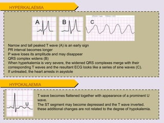 Narrow and tall peaked T wave (A) is an early sign
PR interval becomes longer
P wave loses its amplitude and may disappear
QRS complex widens (B)
When hyperkalemia is very severe, the widened QRS complexes merge with their
corresponding T waves and the resultant ECG looks like a series of sine waves (C).
If untreated, the heart arrests in asystole
HYPOKALAEMIA
T wave becomes flattened together with appearance of a prominent U
wave.
The ST segment may become depressed and the T wave inverted.
these additional changes are not related to the degree of hypokalemia.
HYPERKALAEMIA
 