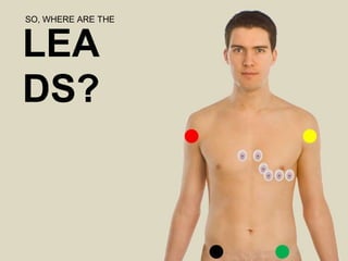 SO, WHERE ARE THE
LEA
DS?
 