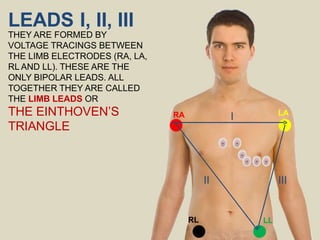 III
II
LEADS I, II, III
THEY ARE FORMED BY
VOLTAGE TRACINGS BETWEEN
THE LIMB ELECTRODES (RA, LA,
RL AND LL). THESE ARE THE
ONLY BIPOLAR LEADS. ALL
TOGETHER THEY ARE CALLED
THE LIMB LEADS OR
THE EINTHOVEN’S
TRIANGLE
RA LA
RL LL
I
 