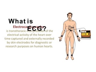Electrocardiography-
is transthoracic interpretation of the
electrical activity of the heart over
time captured and externally recorded
by skin electrodes for diagnostic or
research purposes on human hearts.
What is
ECG?
 