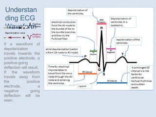 If a wavefront of
depolarization
travels towards the
positive electrode, a
positive-going
deflection will result.
If the
travels
the
waveform
away from
positive
a
going
will be
electrode,
negative
deflection
seen.
Understan
ding ECG
Waveform
 