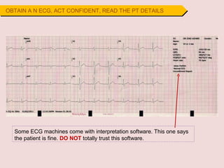 OBTAIN A N ECG, ACT CONFIDENT, READ THE PT DETAILS
Some ECG machines come with interpretation software. This one says
the patient is fine. DO NOT totally trust this software.
 