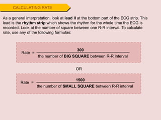 300
CALCULATING RATE
As a general interpretation, look at lead II at the bottom part of the ECG strip. This
lead is the rhythm strip which shows the rhythm for the whole time the ECG is
recorded. Look at the number of square between one R-R interval. To calculate
rate, use any of the following formulas:
the number of BIG SQUARE between R-R interval
OR
Rate =
1500
the number of SMALL SQUARE between R-R interval
Rate =
 