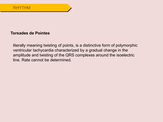 RHYTHM
Torsades de Pointes
literally meaning twisting of points, is a distinctive form of polymorphic
ventricular tachycardia characterized by a gradual change in the
amplitude and twisting of the QRS complexes around the isoelectric
line. Rate cannot be determined.
 