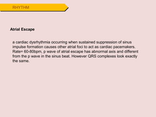 RHYTHM
Atrial Escape
a cardiac dysrhythmia occurring when sustained suppression of sinus
impulse formation causes other atrial foci to act as cardiac pacemakers.
Rate= 60-80bpm, p wave of atrial escape has abnormal axis and different
from the p wave in the sinus beat. However QRS complexes look exactly
the same.
 