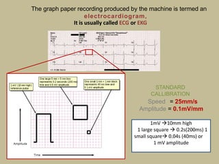 The graph paper recording produced by the machine is termed an
electrocardiogram,
It is usually called ECG or EKG
STANDARD
CALLIBRATION
Speed = 25mm/s
Amplitude = 0.1mV/mm
1mV 10mm high
1 large square  0.2s(200ms) 1
small square 0.04s (40ms) or
1 mV amplitude
 