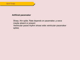 RHYTHM
Artificial pacemaker
Sharp, thin spike. Rate depends on pacemaker, p wave
maybe absent or present
Ventricular paced rhythm shows wide ventricular pacemaker
spikes
 