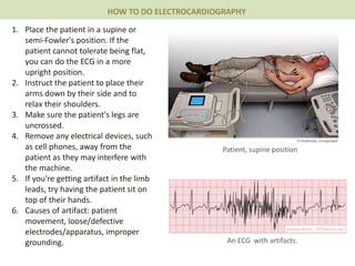 1. Place the patient in a supine or
semi-Fowler's position. If the
patient cannot tolerate being flat,
you can do the ECG in a more
upright position.
2. Instruct the patient to place their
arms down by their side and to
relax their shoulders.
3. Make sure the patient's legs are
uncrossed.
4. Remove any electrical devices, such
as cell phones, away from the
patient as they may interfere with
the machine.
5. If you're getting artifact in the limb
leads, try having the patient sit on
top of their hands.
6. Causes of artifact: patient
movement, loose/defective
electrodes/apparatus, improper
grounding.
HOW TO DO ELECTROCARDIOGRAPHY
An ECG with artifacts.
Patient, supine position
 