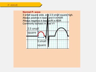 Normal P- wave
3 small square wide, and 2.5 small square high.
Always positive in lead I and II in NSR
Always negative in lead aVR in NSR
Commonly biphasic in lead V1
P -WAVE
 
