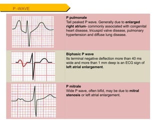 P -WAVE
P pulmonale
Tall peaked P wave. Generally due to enlarged
right atrium- commonly associated with congenital
heart disease, tricuspid valve disease, pulmonary
hypertension and diffuse lung disease.
Biphasic P wave
Its terminal negative deflection more than 40 ms
wide and more than 1 mm deep is an ECG sign of
left atrial enlargement.
P mitrale
Wide P wave, often bifid, may be due to mitral
stenosis or left atrial enlargement.
 