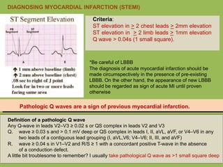 Criteria:
ST elevation in > 2 chest leads > 2mm elevation
ST elevation in > 2 limb leads > 1mm elevation
Q wave > 0.04s (1 small square).
*Be careful of LBBB
The diagnosis of acute myocardial infarction should be
made circumspectively in the presence of pre-existing
LBBB. On the other hand, the appearance of new LBBB
should be regarded as sign of acute MI until proven
otherwise
Pathologic Q waves are a sign of previous myocardial infarction.
Definition of a pathologic Q wave
Any Q-wave in leads V2–V3 ≥ 0.02 s or QS complex in leads V2 and V3
Q. wave ≥ 0.03 s and > 0.1 mV deep or QS complex in leads I, II, aVL, aVF, or V4–V6 in any
two leads of a contiguous lead grouping (I, aVL,V6; V4–V6; II, III, and aVF)
R. wave ≥ 0.04 s in V1–V2 and R/S ≥ 1 with a concordant positive T-wave in the absence
of a conduction defect.
A little bit troublesome to remember? I usually take pathological Q wave as >1 small square deep
DIAGNOSING MYOCARDIAL INFARCTION (STEMI)
 