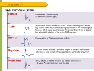 ST SEGMENT
ST-ELEVATION MI (STEMI)
0 HOUR
1-24H
Day 1-2
Days later
Weeks later
Pronounced T Wave initially
ST elevation (convex type)
Depressed R Wave, and Pronounced T Wave. Pathological Q waves
may appear within hours or may take greater than 24 hr.- indicating full-
thickness MI. Q wave is pathological if it is wider than 40 ms or deeper
than a third of the height of the entire QRS complex
Exaggeration of T Wave continues for 24h.
T Wave inverts as the ST elevation begins to resolve. Persistent ST
elevation is rare except in the presence of a ventricular aneurysm.
ECG returns to normal T wave, but retains pronounced
Q wave. An old infarct may look like this
 