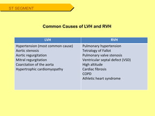 ST SEGMENT
Common Causes of LVH and RVH
LVH RVH
Hypertension (most common cause)
Aortic stenosis
Aortic regurgitation
Mitral regurgitation
Coarctation of the aorta
Hypertrophic cardiomyopathy
Pulmonary hypertension
Tetralogy of Fallot
Pulmonary valve stenosis
Ventricular septal defect (VSD)
High altitude
Cardiac fibrosis
COPD
Athletic heart syndrome
 