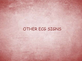 OTHER ECG SIGNS
 