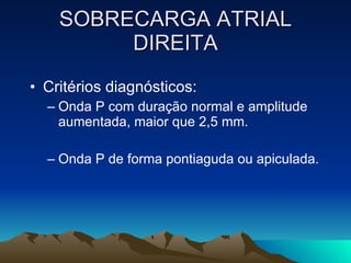 SOBRECARGA ATRIAL
         DIREITA
• Critérios diagnósticos:
  – Onda P com duração normal e amplitude
    aumentada, maior que 2,5 mm.

  – Onda P de forma pontiaguda ou apiculada.
 