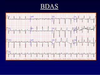 Ecg 4.0