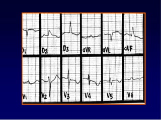 Ecg 4.0