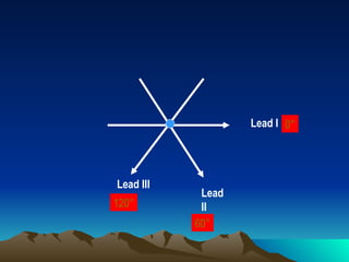 Lead I 0°




Lead III
            Lead
120°        II
           60°
 