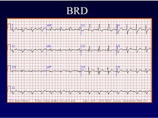 Ecg 4.0
