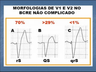 Ecg 5.0