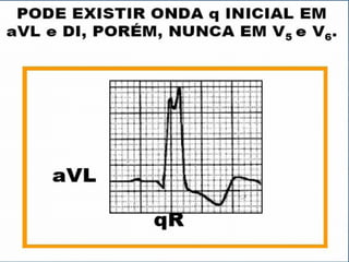 Ecg 5.0